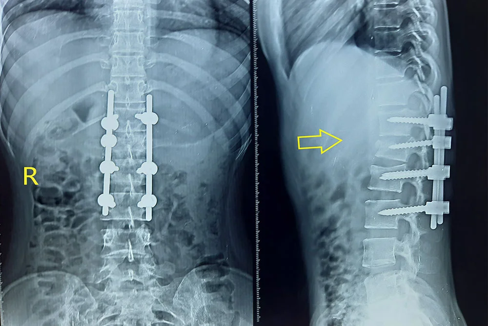 Spine Care and Orthopaedic Treatment Services in Trichy