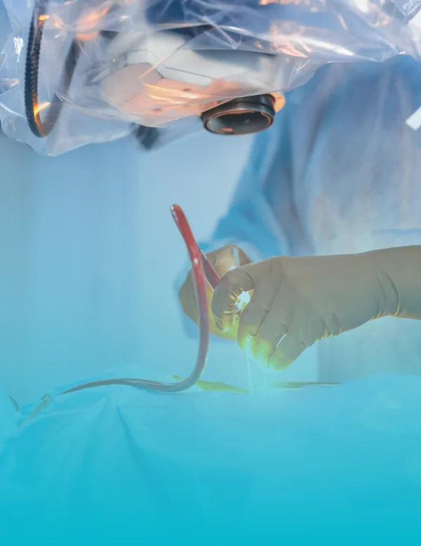 Vascular Surgery Treatment and Specialist Care at Viswanathan Hospital Trichy